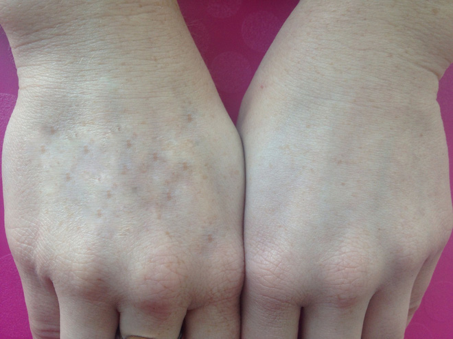 Nhìn tay bắt bệnh: 30 vấn đề sức khỏe sẽ thể hiện rõ qua vẻ ngoài của bàn tay - Ảnh 7.