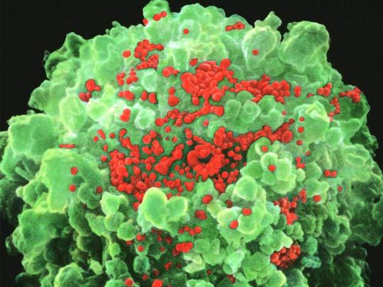 Tìm ra loại thuốc khiến con người bớt sợ HIV - 1