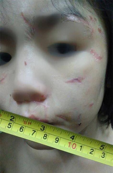 Hãy nhìn thật kỹ vào những vết sẹo của em bé bị bạo hành, bạn sẽ thấy cả sự vô cảm và bất lực của chính mình - Ảnh 3.